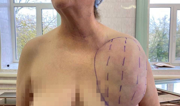 Фото: ГКБ №6, Тверь