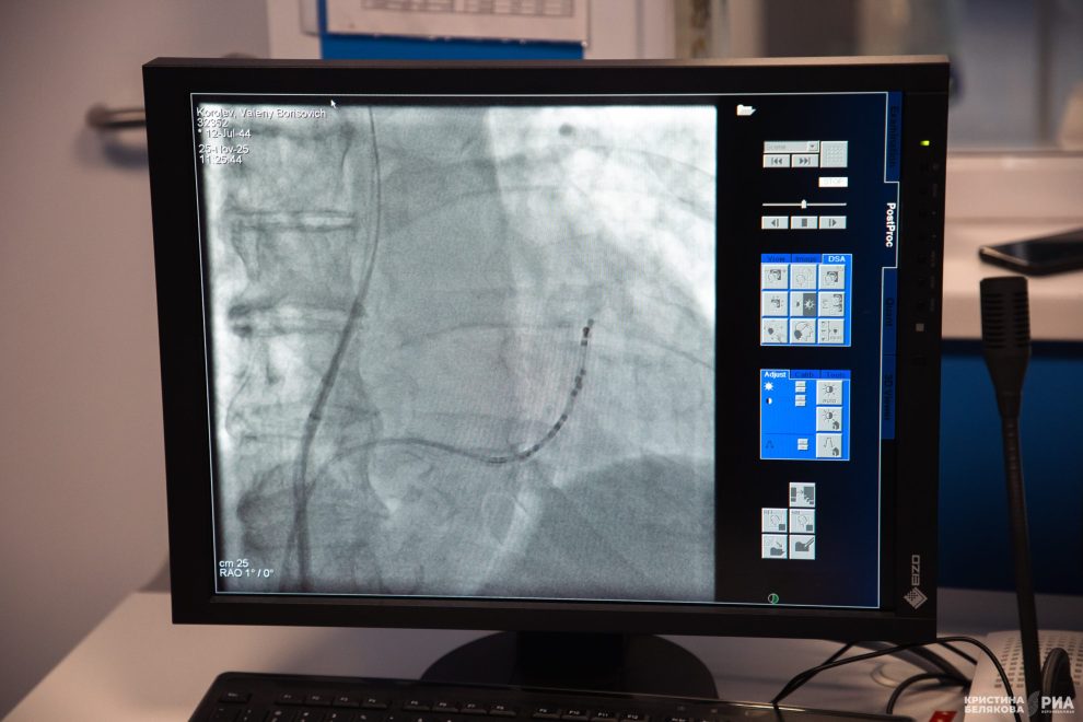 легкие, снимок, больница